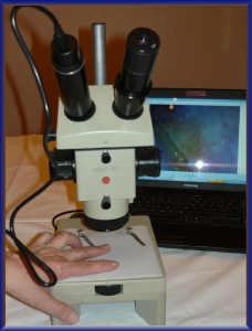 Kapillármikrószkópia